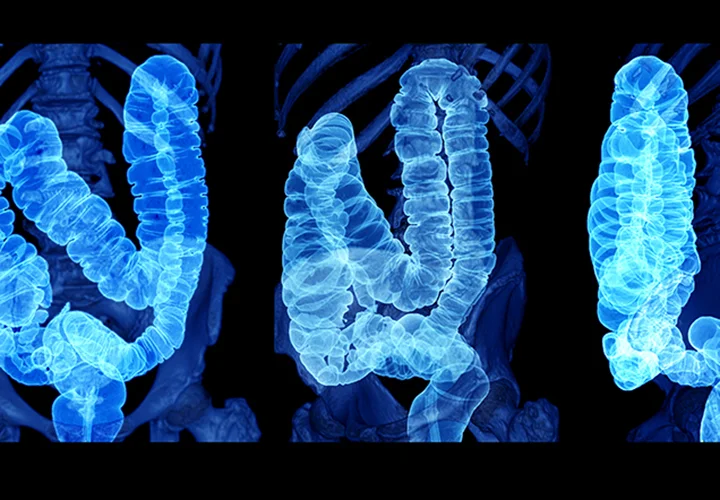 imagen-valor-de-tac-abdomen