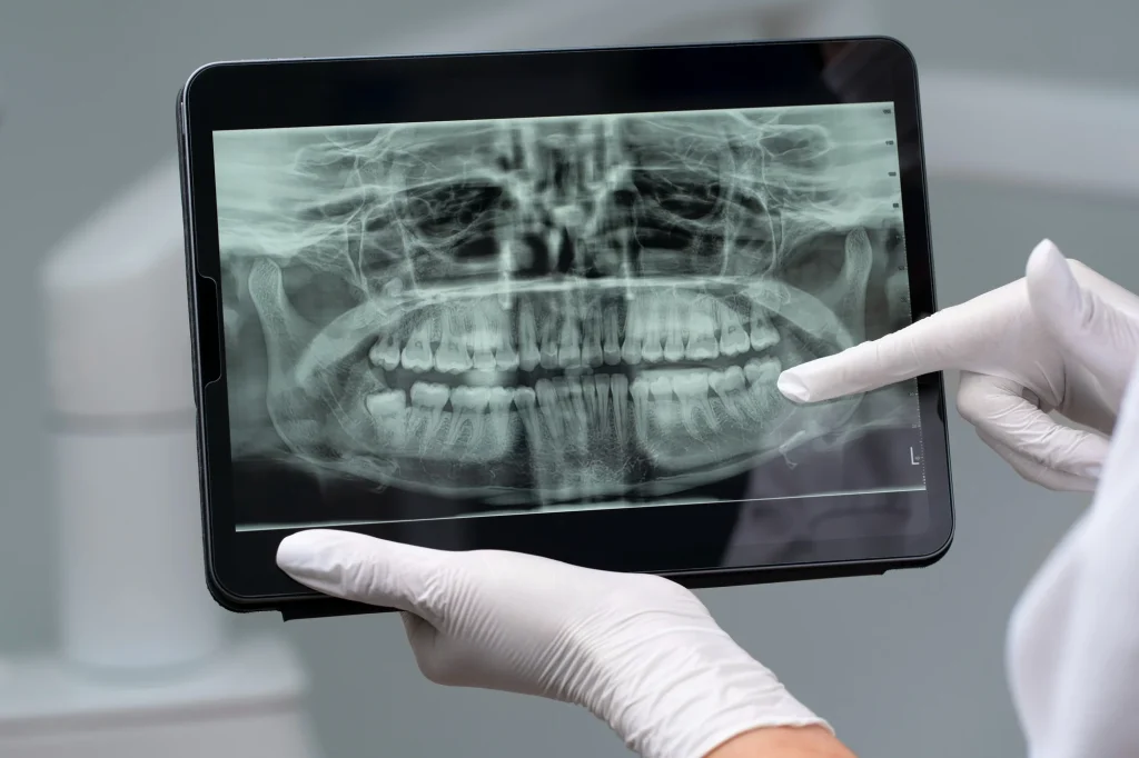 imagen-valor-de-tac-de-orbitas-maxilofacial