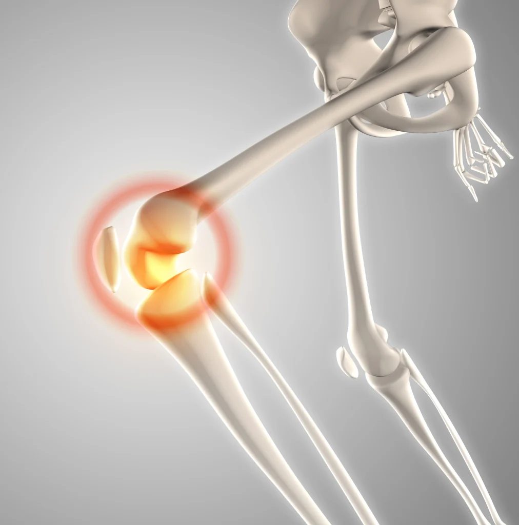 imagen-valor-de-tac-scanner-rodilla
