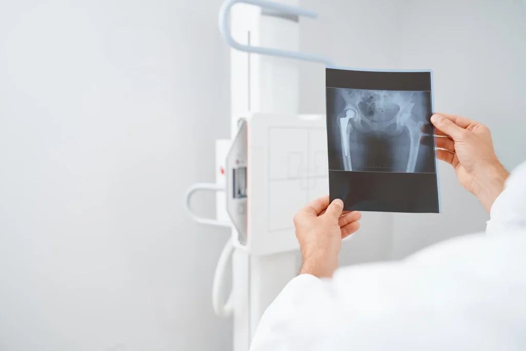 imagn-valor-de-tac-de-abdomen-y-pelvis