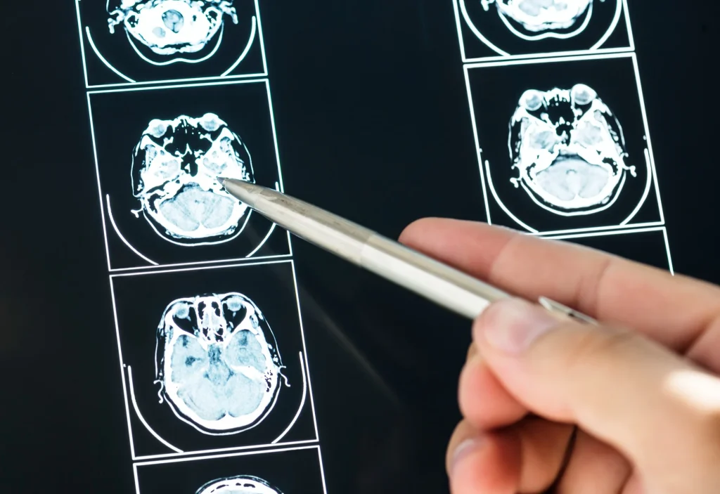 imgen-valor-de-tac-angiotac-de-cerebro