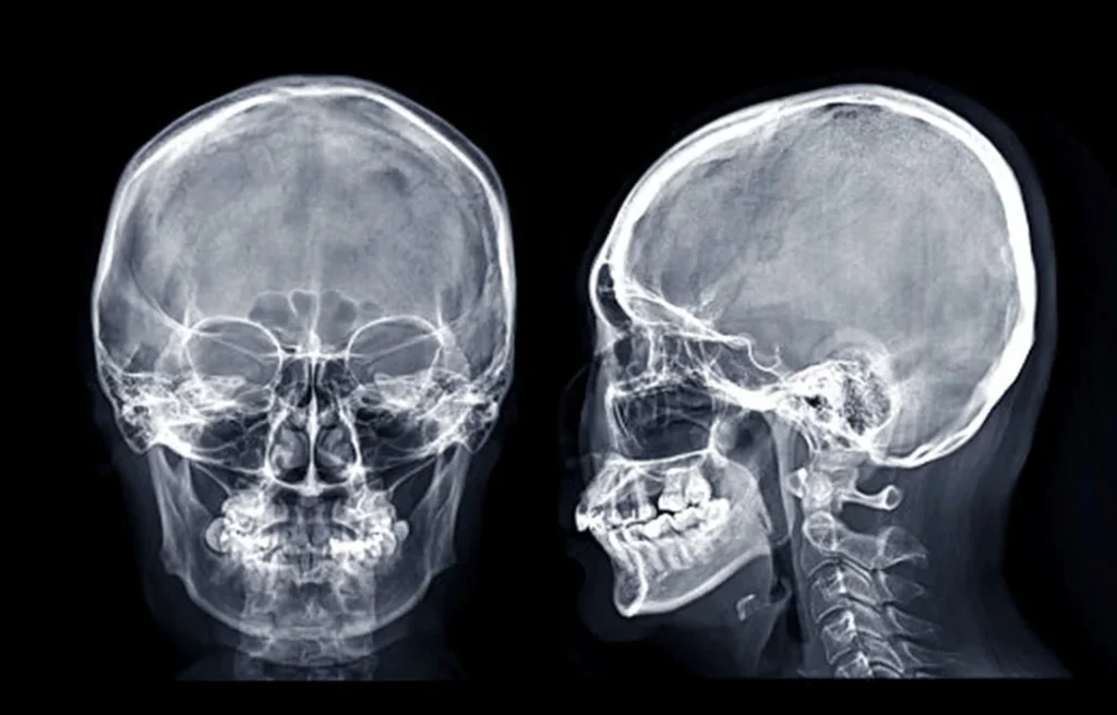 imagen-de-valor-radiografia-de-columna-total
