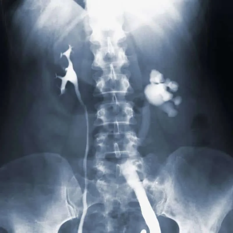 imagen-valor-de-radiografia-columna-lumbar