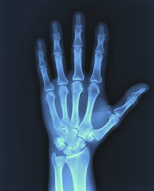 imagen-valor-de-radiografia-de-mano