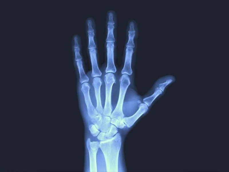 imagen-valor-de-radiografia-de-muneca