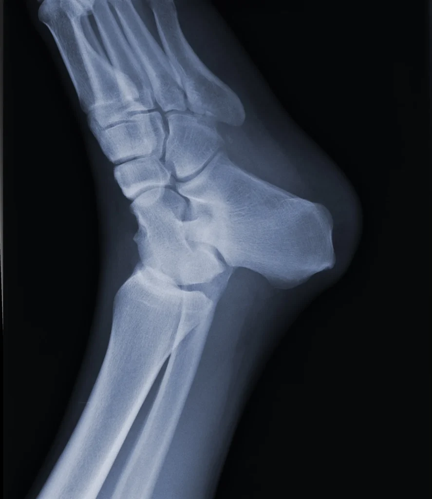 imagen-valor-de-radiografia-pie-y-tobillo