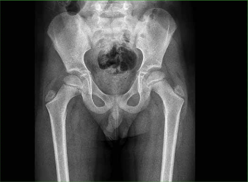 imagen-valor-de-radiografia-torax